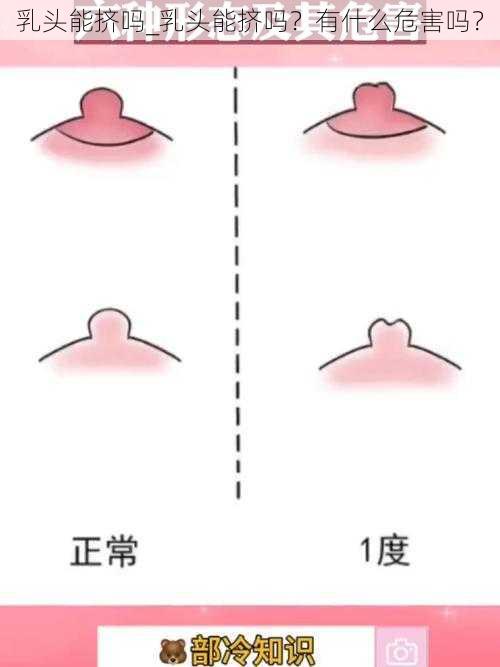 乳头能挤吗_乳头能挤吗？有什么危害吗？